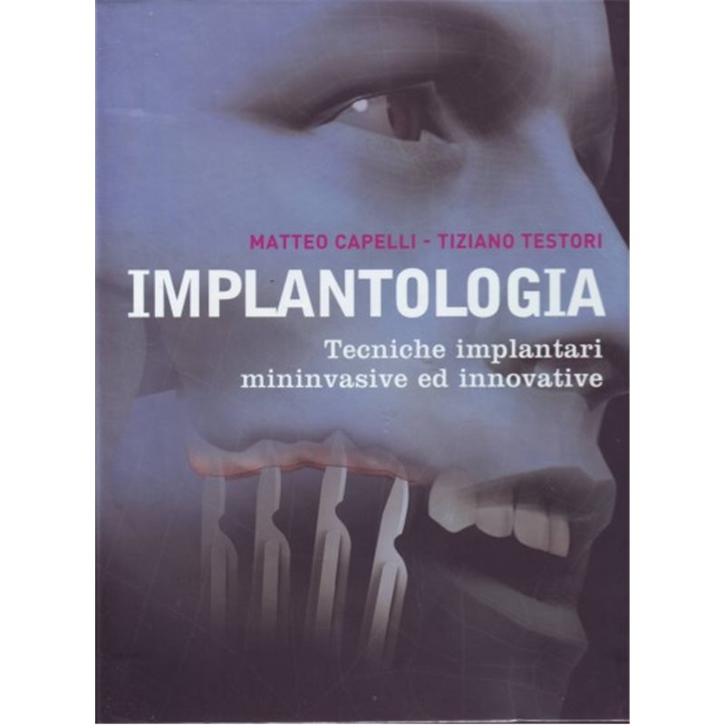 IMPLANTOLOGIA - Tecniche implantari mininvasive ed innovative